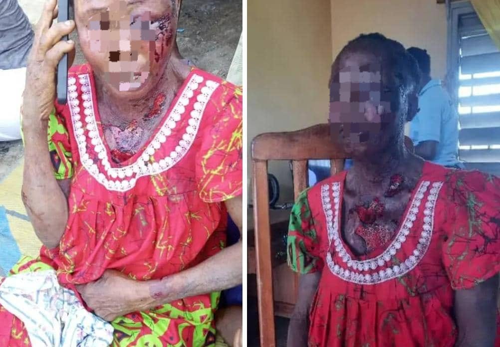 ‎Franceville : une septuagénaire échappe à un assassinat en forêt‎