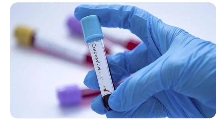 ‎Gabon/Santé : pas de recrudescence de cas de Covid- 19 selon les autorités sanitaires‎‎